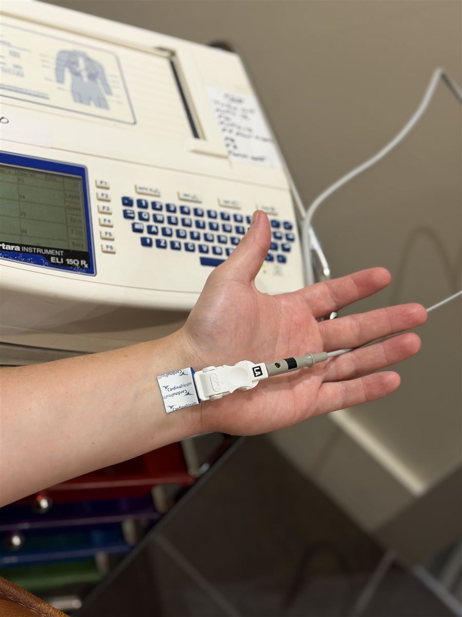 12-lead electrocardiogram reading